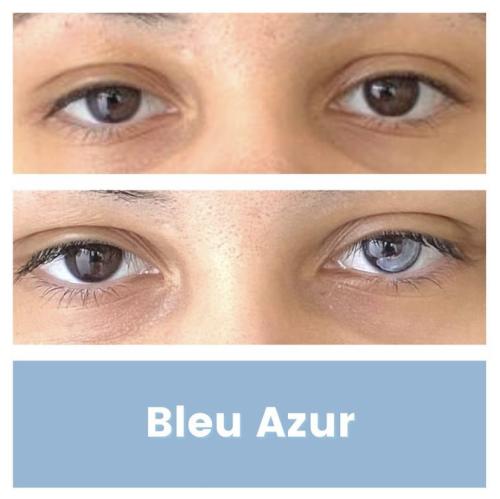 Bleu-Azur-5-heterochromie
